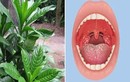 6 loại lá dân dã trị viêm họng nhạy hơn kháng sinh