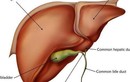 3 loại gia vị có hại cho gan hơn cả rượu