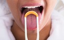 Màu lưỡi cảnh báo mức cholesterol cao trong cơ thể