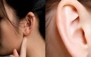 Đôi tai có những đặc điểm này là người rất may mắn