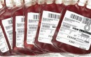 Tại sao AB là nhóm máu hiếm nhất thế giới?