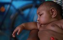 Chùm ảnh châu Mỹ gồng mình chống virus Zika ăn não 