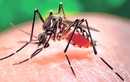 Mỹ phát hiện 14 trường hợp nghi nhiễm Zika qua đường tình dục