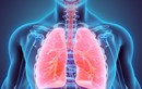 Bệnh bụi phổi gây loạt biến chứng: Điều trị có hiệu quả?