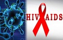 Dấu hiệu nhiễm HIV nhiều người không biết