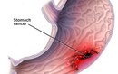 Giảm cân bằng rượu, phúc ít họa nhiều