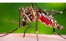 Mỹ ghi nhận trường hợp tử vong đầu tiên do virus Zika