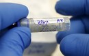 Thêm 5 trường hợp nhiễm virus Zika ở TP HCM