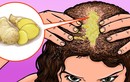 9 cách kích thích mọc tóc tự nhiên để tránh bị hói đầu