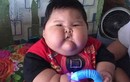 Bé trai 1 tuổi béo phì nặng 27kg, to bằng bé 8 tuổi