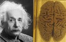 Bộ não của thiên tài Einstein được "mổ xẻ" thế nào? 