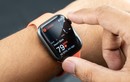 Khôi hài khi Apple Watch bị kiện vì tính năng theo dõi nhịp tim