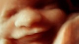 Hình ảnh 3D đáng yêu về thai nhi cười trong bụng mẹ