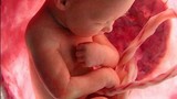 Trẻ còi xương ngay trong bào thai