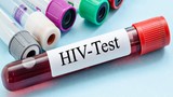 Virus giống HIV, nguy cơ lây sang người nguy hiểm sao?