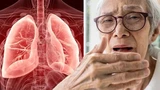 Triệu chứng nhiễm trùng phổi ít người để ý