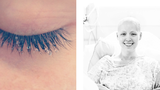 Bộ ảnh chân thực của cô gái mắc bệnh ung thư vú