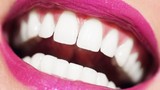 Có thể tái tạo răng từ...nước tiểu?
