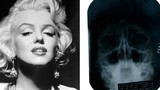 Lộ bằng chứng Marilyn Monroe phẫu thuật thẩm mỹ