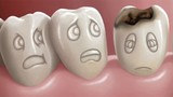 3 loại kem đánh răng không nên mua, tiềm ẩn mối nguy sức khỏe