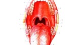 8 phương pháp chẩn đoán ung thư mũi họng