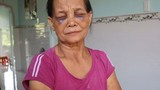 Con dâu đánh mẹ chồng tím mặt ở Bình Phước: Phạt 2 triệu đồng