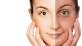 Màu sắc da mặt tiết lộ gì về sức khỏe và tuổi của bạn?