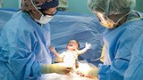 Bác sĩ cắt cụt ngón tay trẻ sơ sinh trong lúc mổ lấy thai 