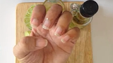 Video: Mẹo trị móng tay bị vàng và dễ gãy