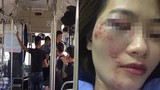 Khởi tố vụ án nhóm thanh niên đánh nữ phụ xe buýt nhập viện 