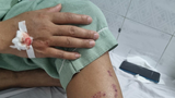 Một luật sư bất ngờ bị tông ngã văng xuống đường ở Hà Nội