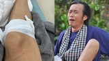 Hoài Linh "tai nạn" chảy máu chân, đối tượng "gây án" cực bất ngờ