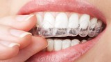 Để nụ cười xinh, học ngay những thói quen ngừa sâu răng từ nha sĩ 