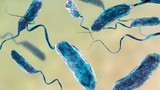 Diễn biến sức khỏe bé gái bị nhiễm 'vi khuẩn ăn thịt người'