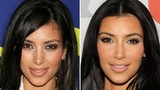 Soi những bộ phận “dao kéo” của Kim Kardashian