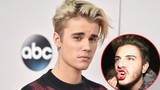 Justin Bieber đấm fan chảy máu miệng