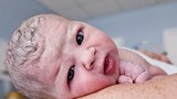 Những tác hại của sinh mổ với bé rất cần biết
