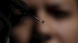 Trẻ sơ sinh nhiễm virus Zika có bị dị tật đầu nhỏ?