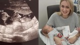 Kỳ lạ bé gái bất ngờ có bạn “chung nhà” sau 3 tháng mẹ mang bầu