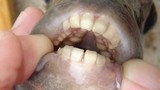 Những hàm răng quái vật khiến con người nhìn là “khiếp vía“