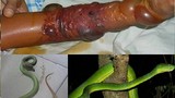 Nọc độc rắn lục đuôi đỏ nguy hiểm cỡ nào?