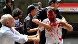 Cảnh sát giải tán biểu tình ở Cairo, 120 người thương vong