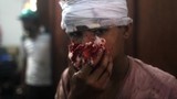 Thế giới lên án bạo lực đẫm máu tại Ai Cập