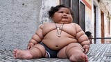 Mắc chứng háu ăn kỳ lạ, bé 8 tháng tuổi nặng 20kg