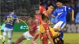 Trước Đỗ Hùng Dũng, V-League từng chứng kiến bao vụ gẫy chân?