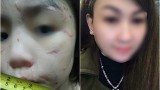 Bé 10 tuổi bị bạo hành: Mẹ kế vẫn lên Facebook khoe bảng điểm của con