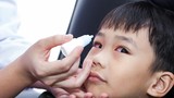 Triệu chứng đau mắt đỏ phổ biến ở trẻ