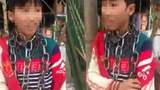 Video: Bé trai ở Thanh Hóa bị quấn vòng xích quanh cổ