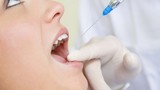 Nhổ răng số 46, nữ bệnh nhân suýt tử vong vì ngộ độc thuốc tê