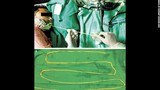 Hãi: Bác sĩ kéo sán dây 1,8 m ra khỏi miệng bệnh nhân
